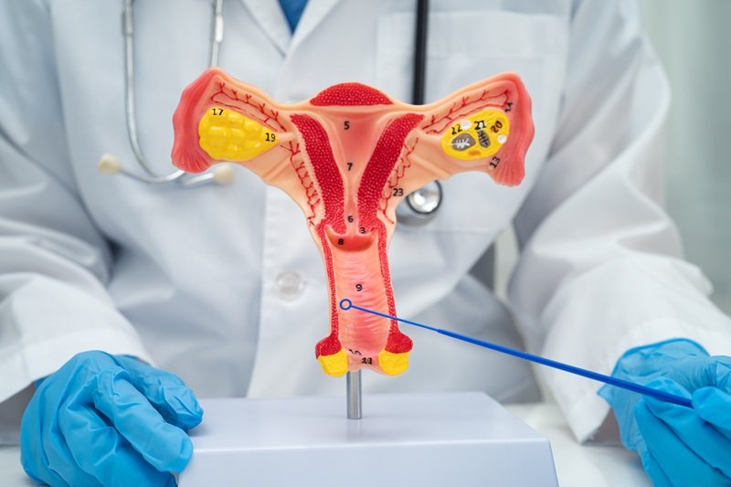 Inseminación intrauterina